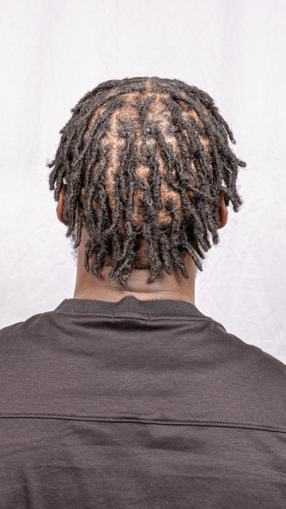 Interlocked locs outcome